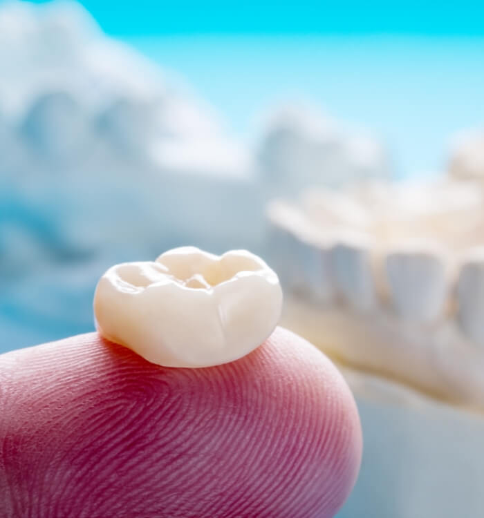 Custom dental crown on fingertip