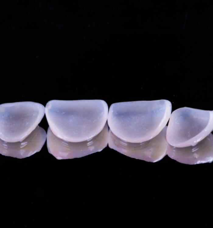 Metal free dental restorations prior to placement