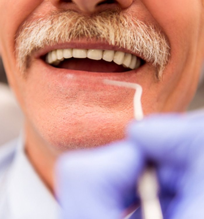 Man with dentures in Montpelier 