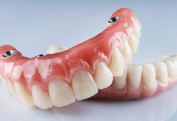 Implant dentures in Montpelier 