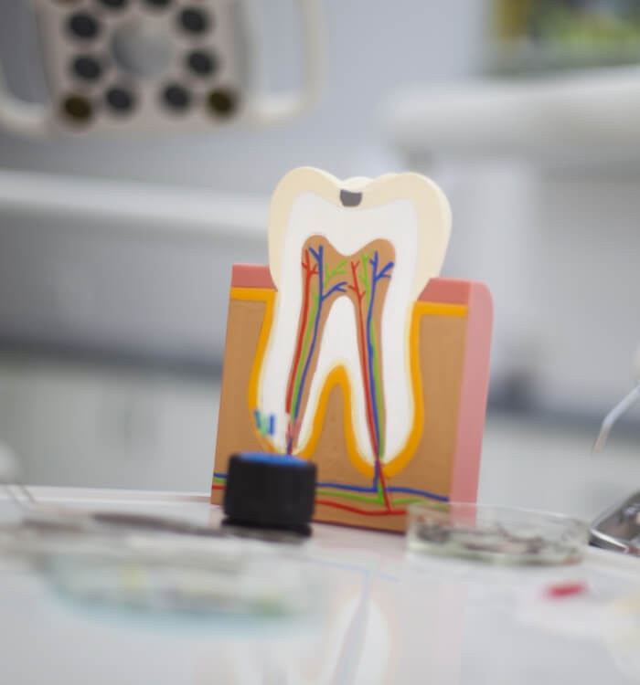 Model inside of a tooth used to explain root canal treatment