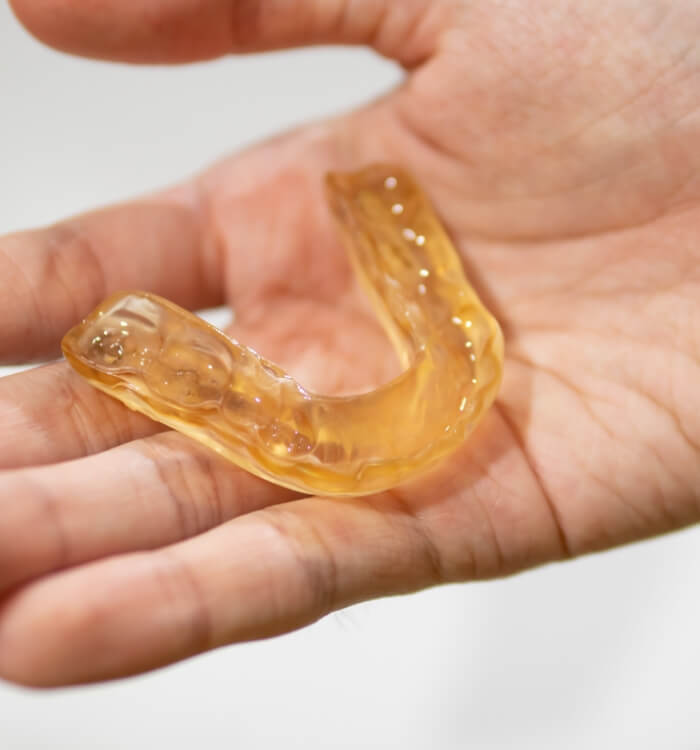 Hand holding a nightguard for bruxism