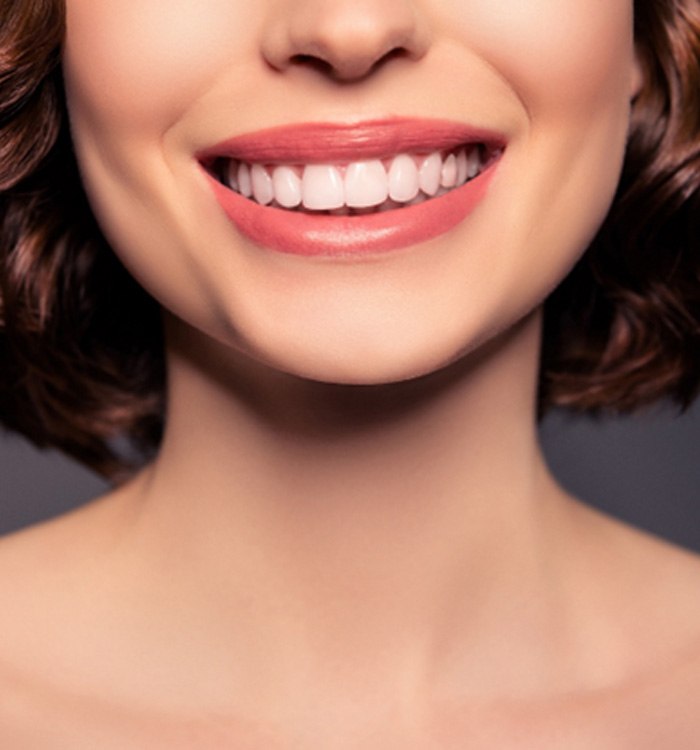 A closeup of a person with veneers smiling