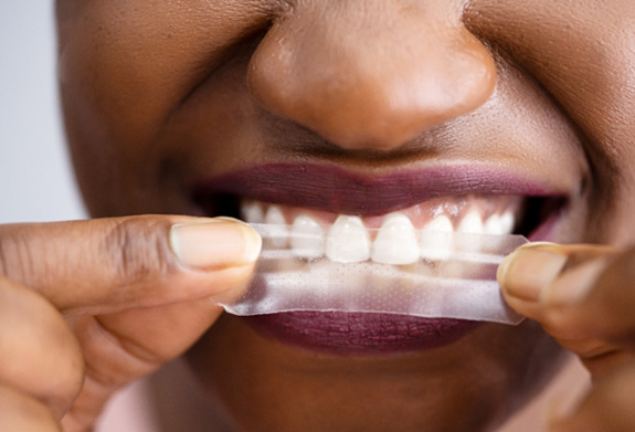 Nose-to-chin view of woman with pretty lipstick applying whitening strip to teeth