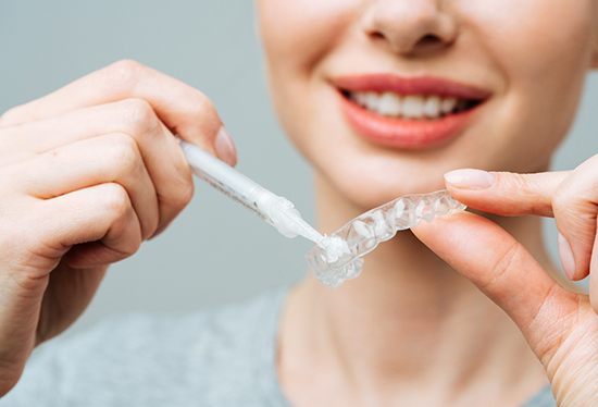 Woman applying teeth whitening gel to custom-fitted applicator tray