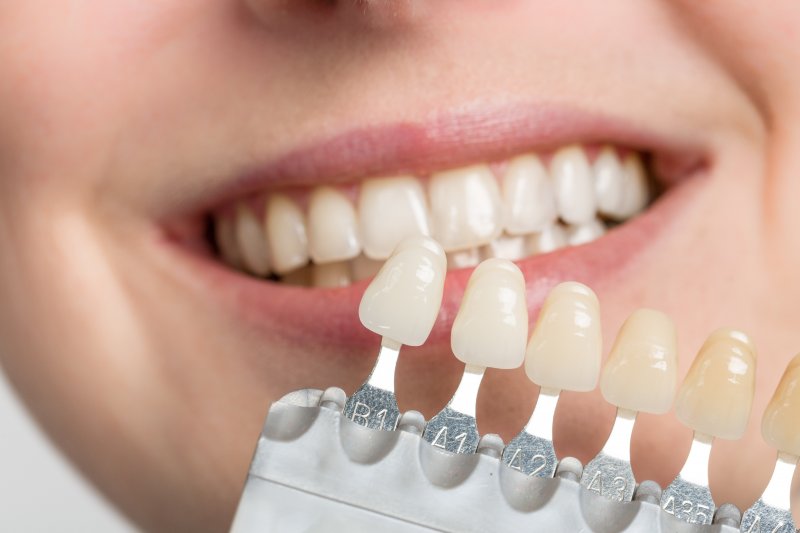 Woman smiling and holding up veneer shade examples in front of her teeth
